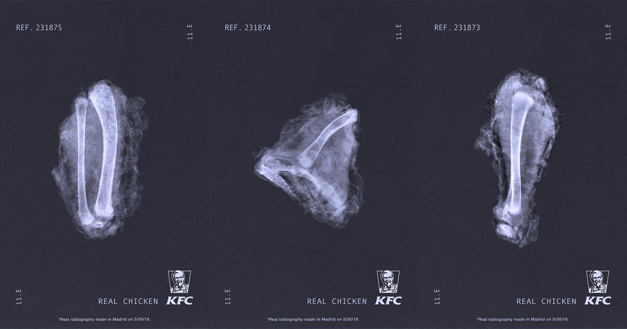 Chiến dịch sáng tạo: KFC chụp X quang gà rán để chứng minh chất lượng sản phẩm
