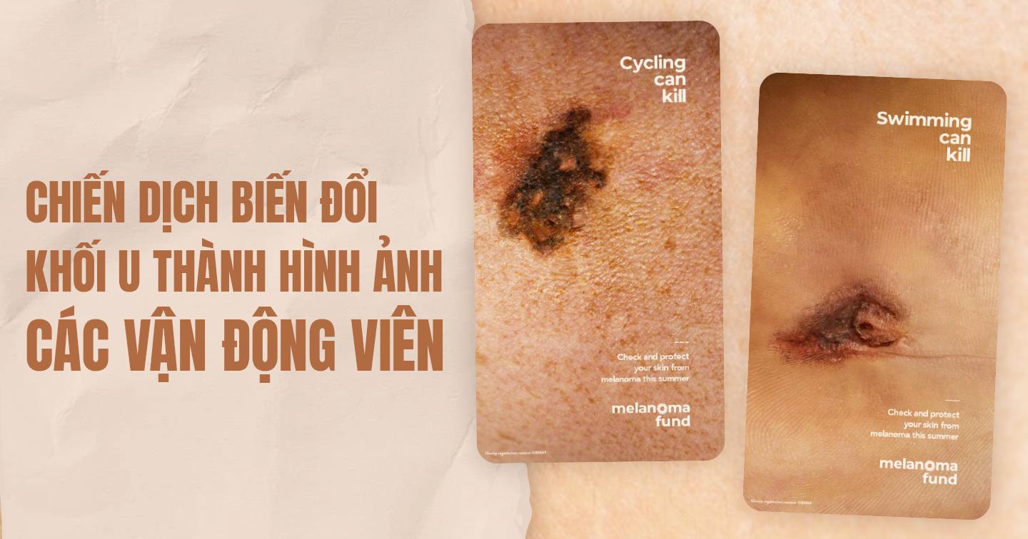 Chiến dịch "Silhouettes" của Quỹ Melanoma: Các khối u ác tính được thiết kế thành hình ảnh vận động viên nhằm nâng cao nhận thức về bảo vệ da khi tham gia thể thao ngoài trời